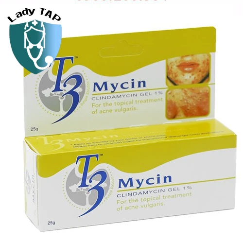 T3 Mycin 25g Hoe - Gel điều trị mụn trứng cá có mủ của Malaysia